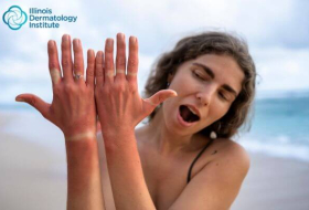 UV Safety Awareness Month: Tips for Soaking Up the Sun