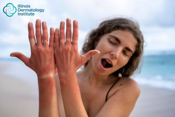 UV Safety Awareness Month: Tips for Soaking Up the Sun
